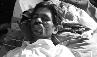 Karachi: Failure to pay extortion causes deprive the worker of his feet