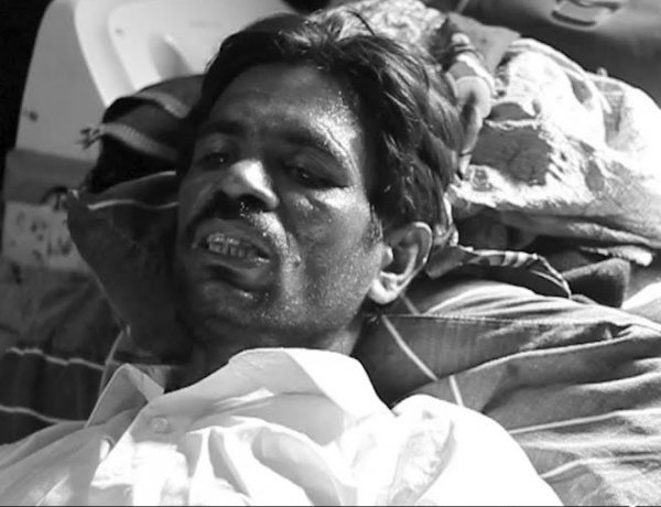 Karachi: Failure to pay extortion causes deprive the worker of his feet